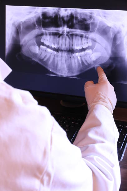 Best Dentist for Tooth Abscess  in Leakesville, MS